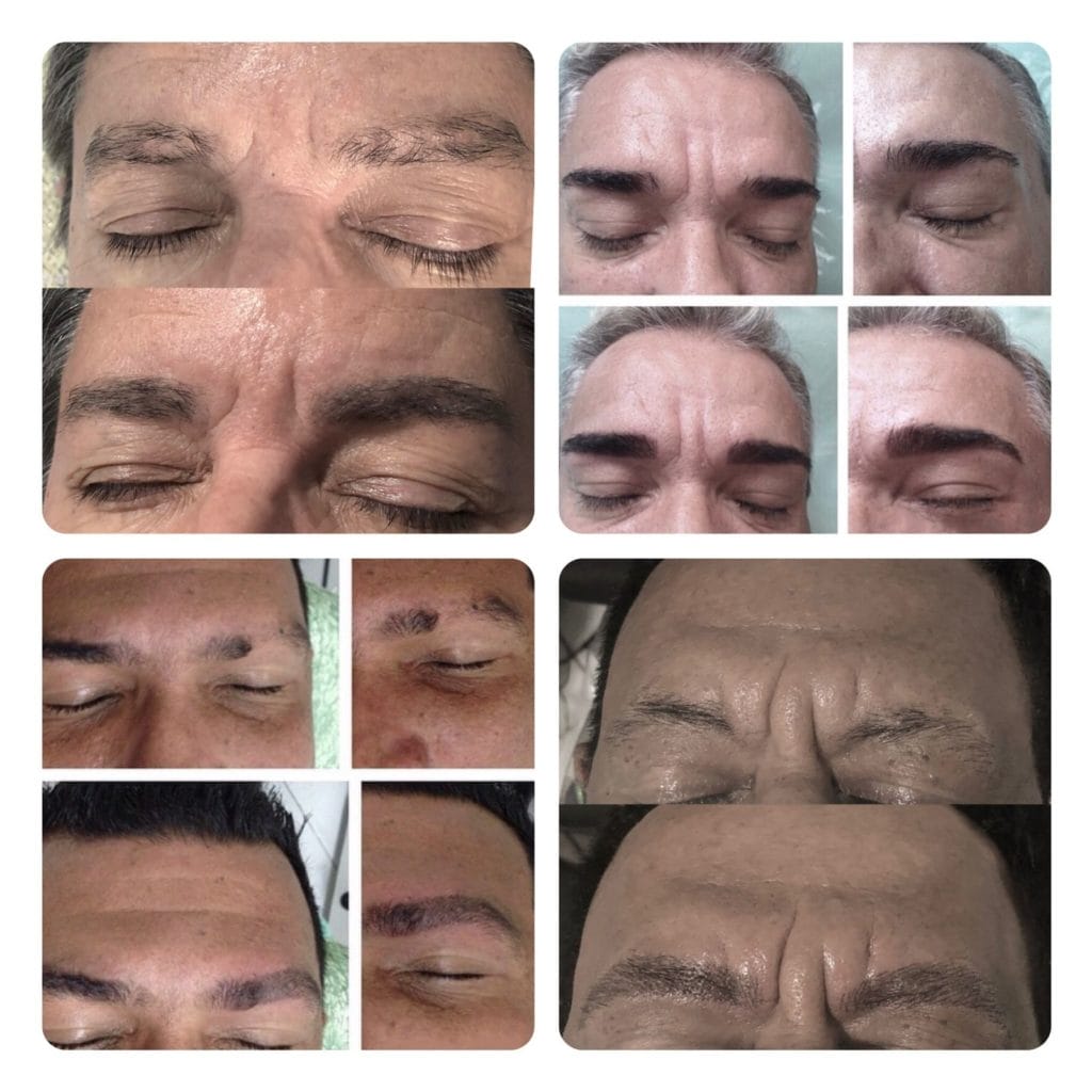 Micropigmentação de Sobrancelhas
